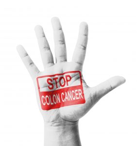 How You Can Prevent Colon Cancer